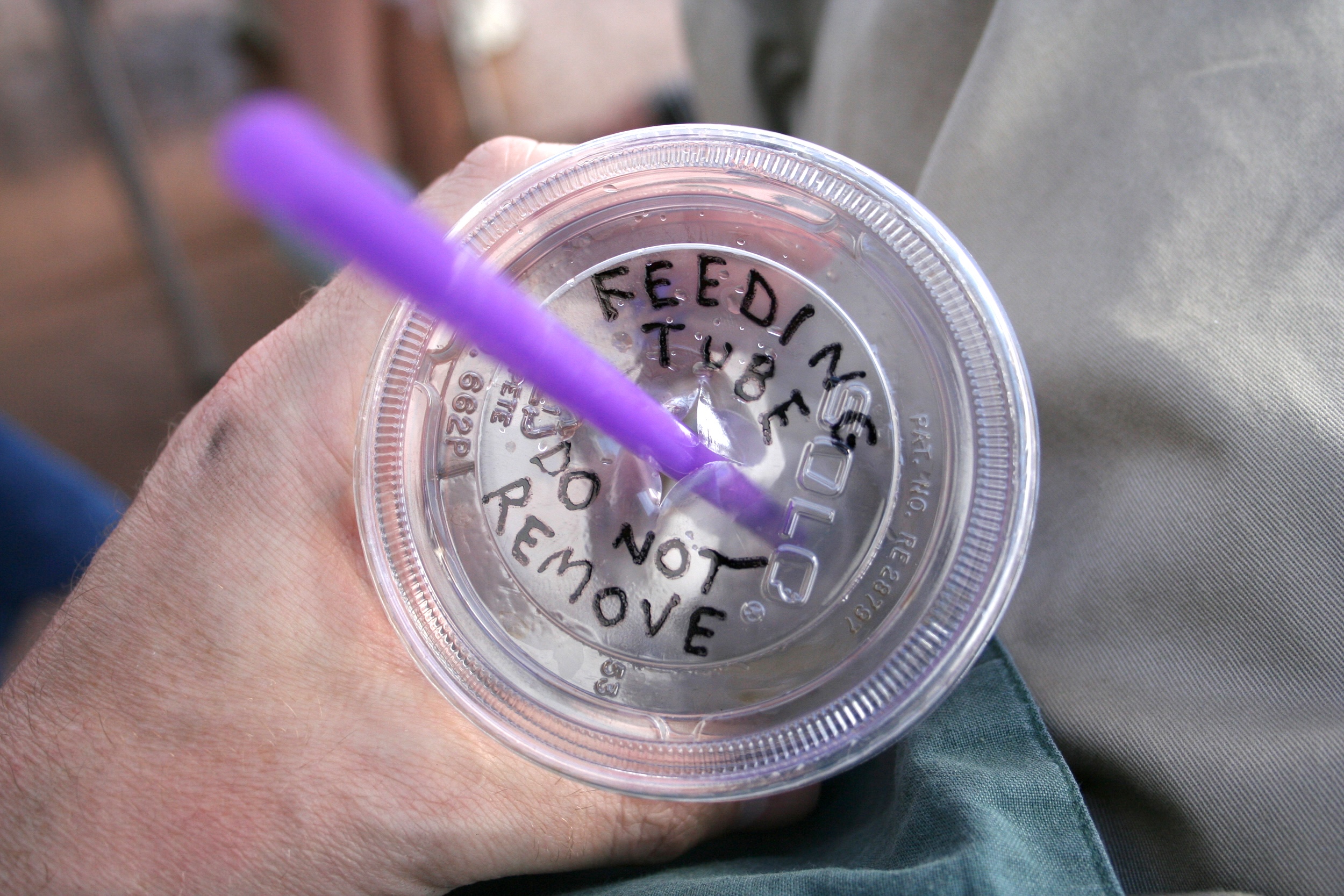 untitled (feeding tube)